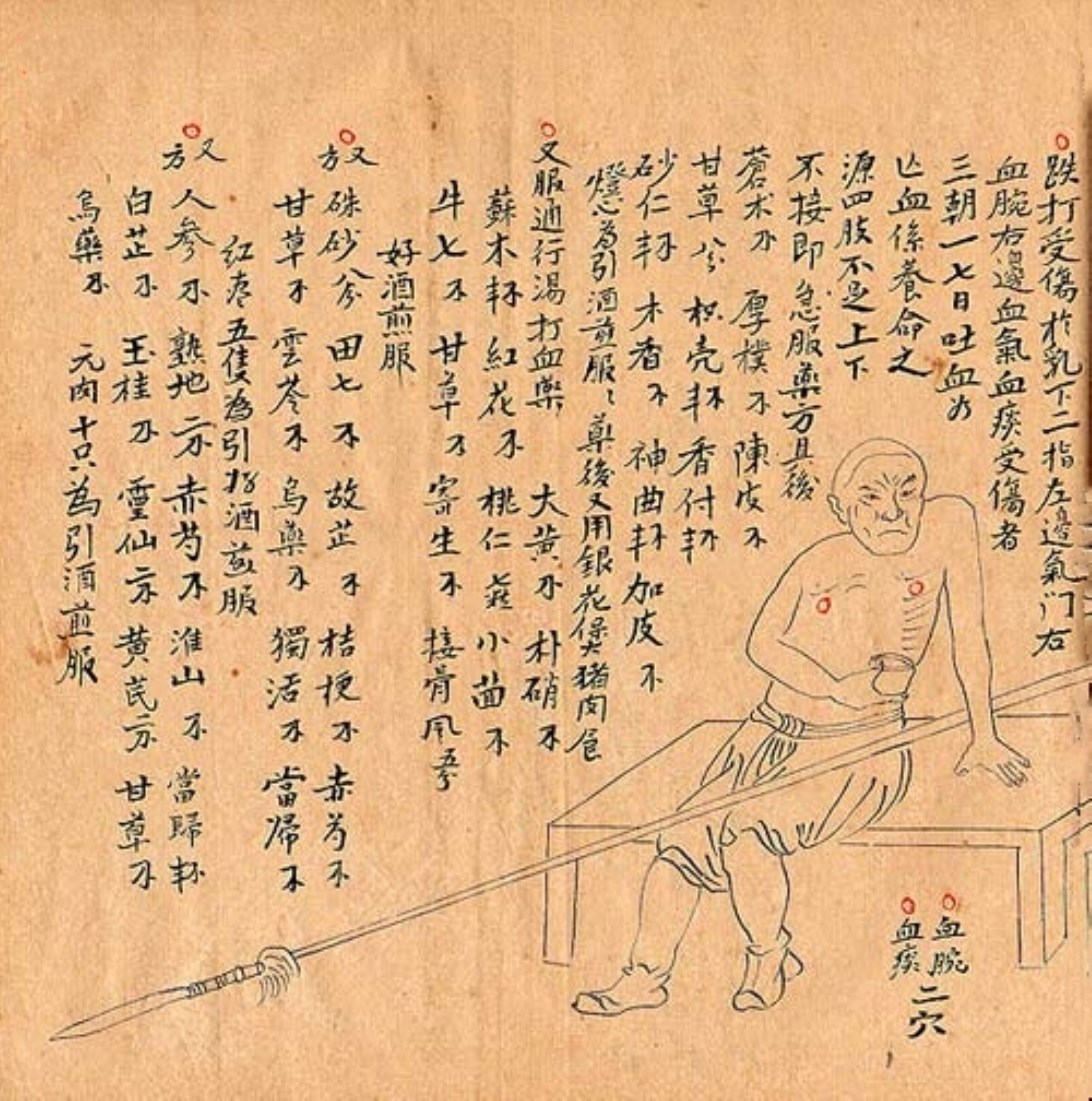 祖传中医治跌打损伤秘方,老中医专医跌打秘方