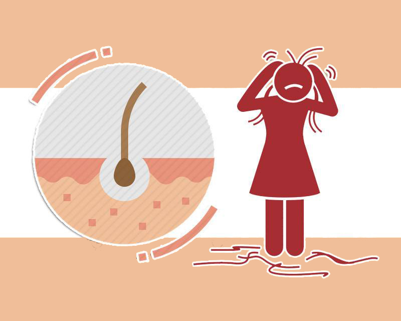 植发为什么这么贵而且容易掉,植发是不是要几万块钱才能搞定