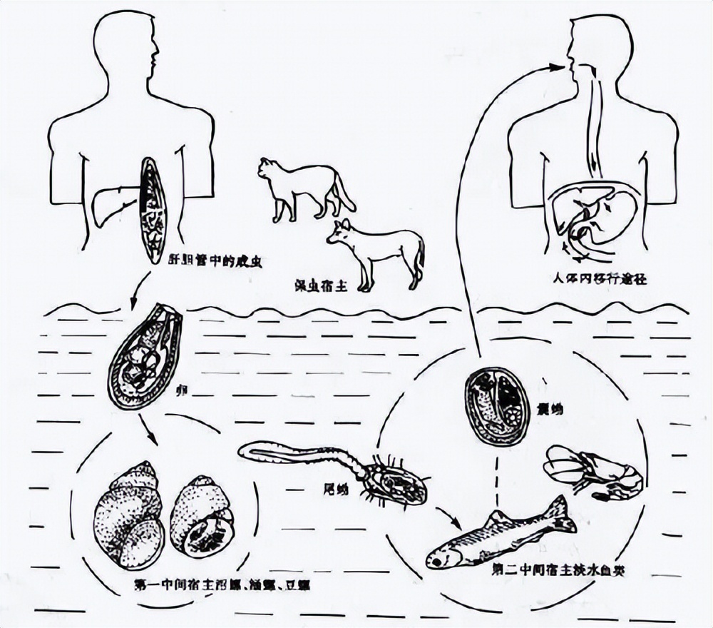 黄建荣教授：以肝损伤为主要表现的寄生虫病诊治进展