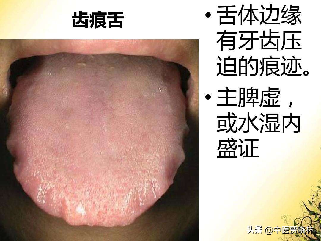 总爱放屁怎么样调理,总是放屁是什么原因怎么调理