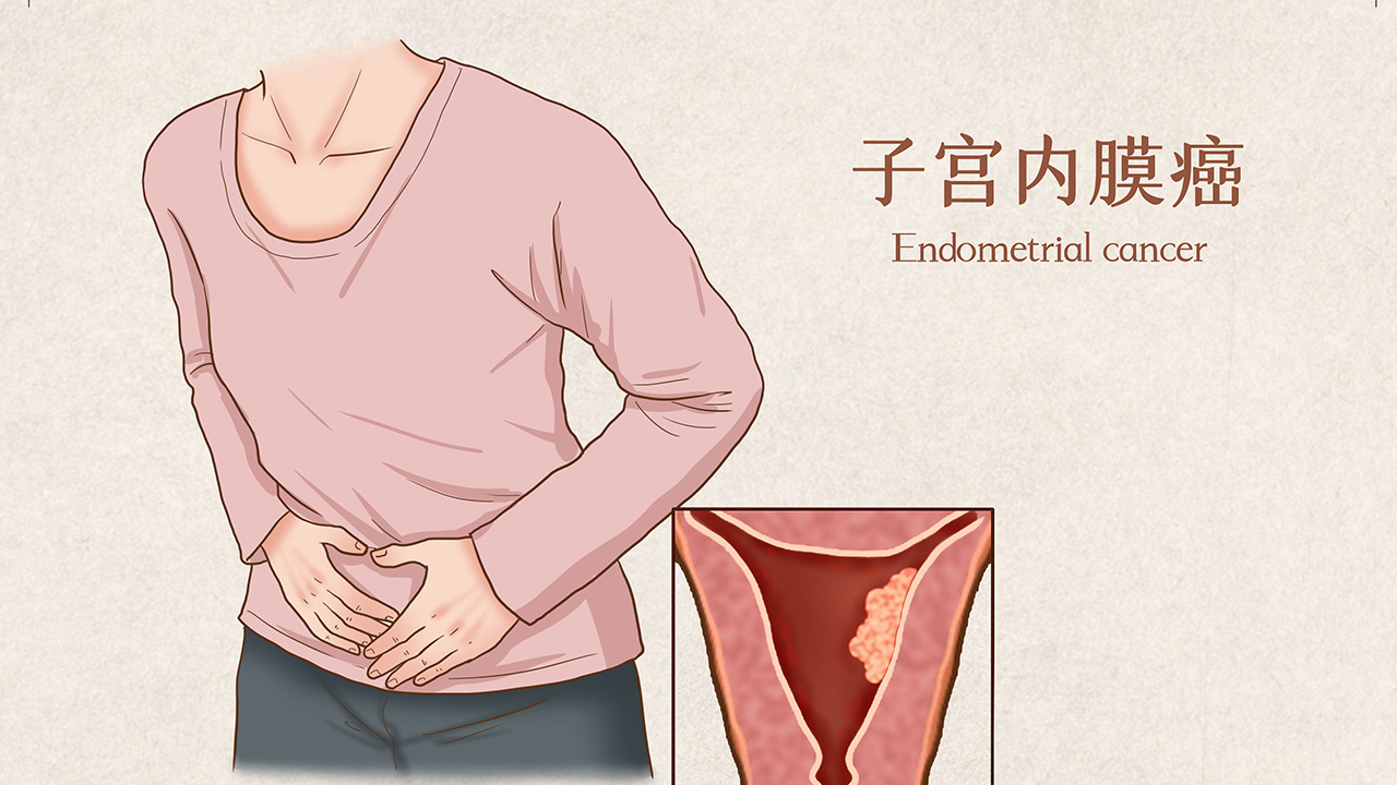 子宫内膜增厚和乳房疼有关系吗,子宫内膜增厚乳房胀痛