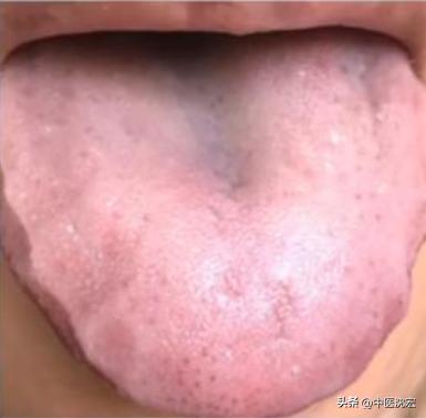 治脾不治肝,养肝疏肝调理脾胃的中成药