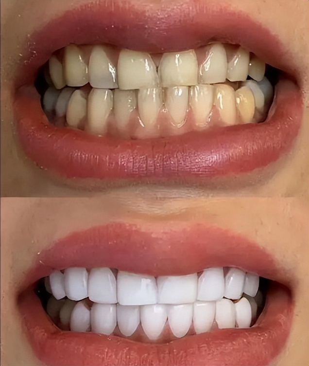 国货好用的洁牙粉推荐,品牌高端牙膏治牙黄牙渍