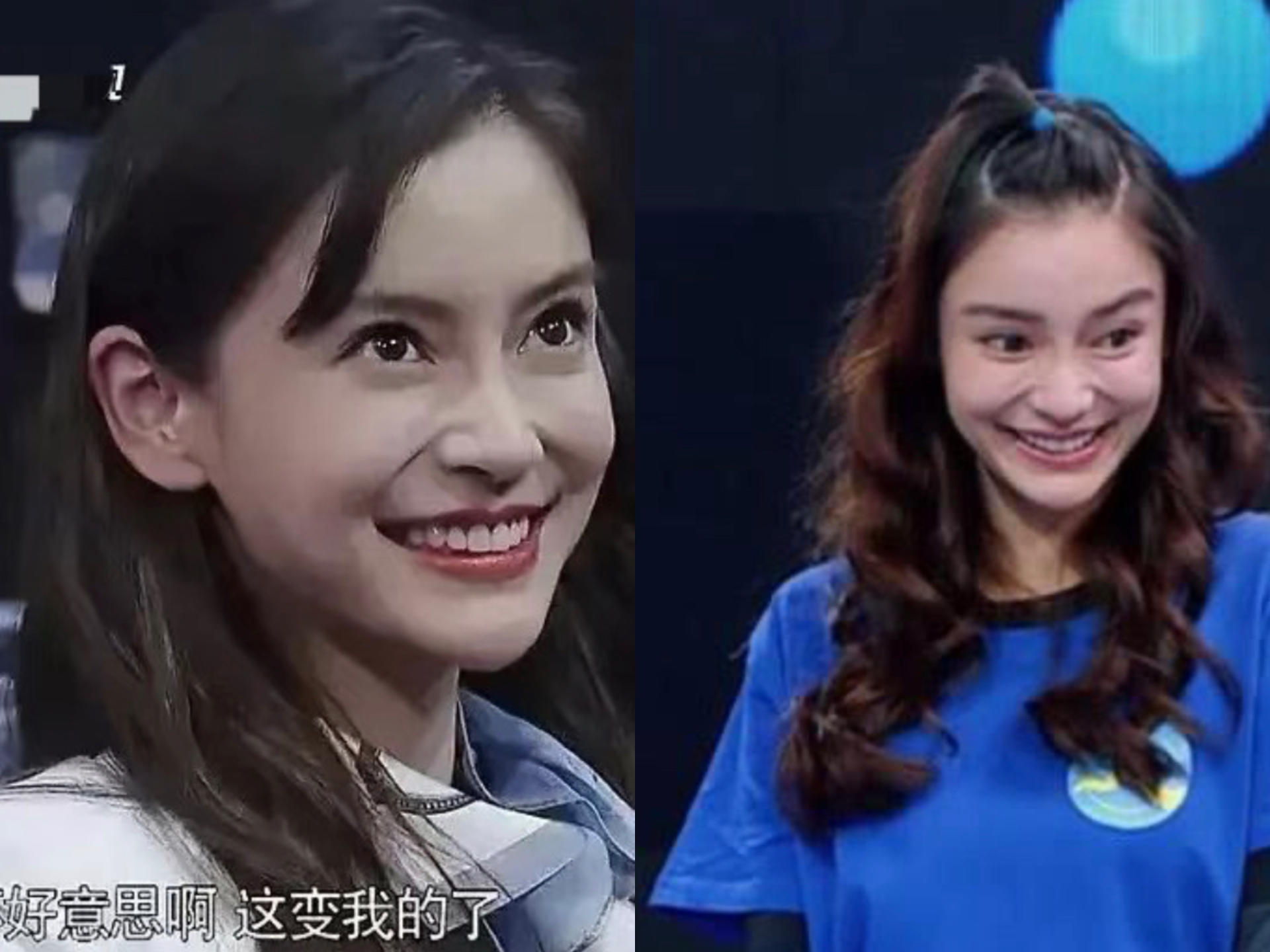 哪些明星整容后遗症越来越严重,整容明星后遗症对比图片