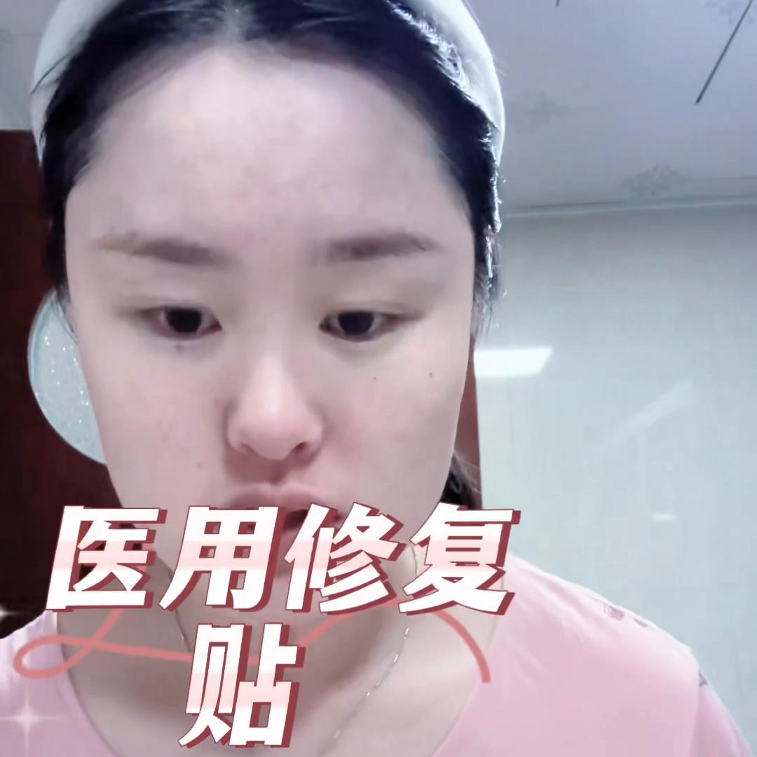 微针怎么修复有效果,水光微针真的有用吗