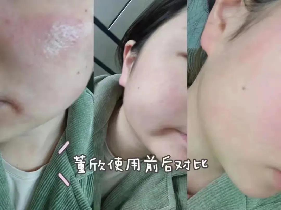 董欣护肤品哪个好用,董欣护肤品推荐