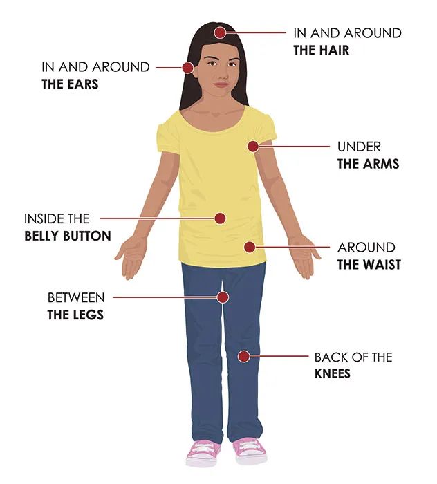 带娃出门游遇到蜱虫千万别乱拔,警惕这三种毒虫带娃出行必看
