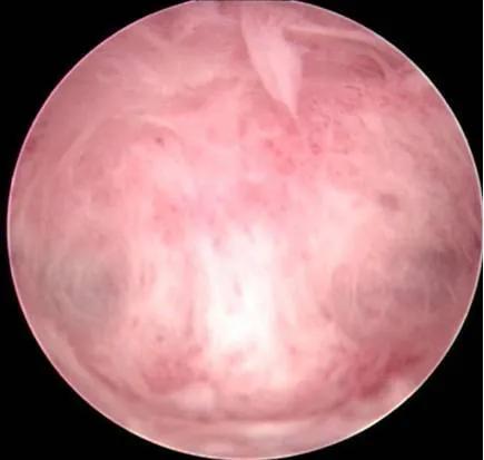 你知道宫腔镜是治疗什么的吗,宫腔镜是治疗什么的