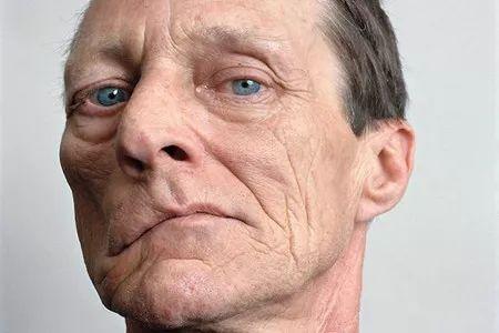 左眼皮上眼皮跳是什么预兆呢,左眼皮上眼皮跳是好运还是厄运