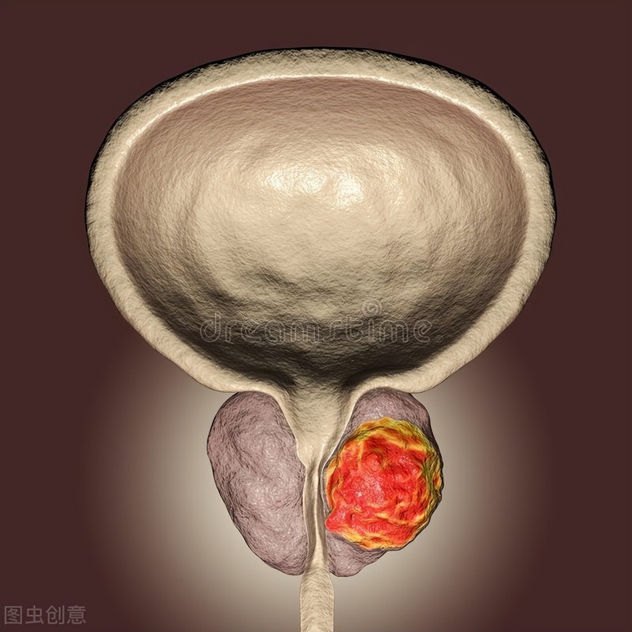 去医院检查前列腺需要哪些步骤,去检查前列腺有什么项目