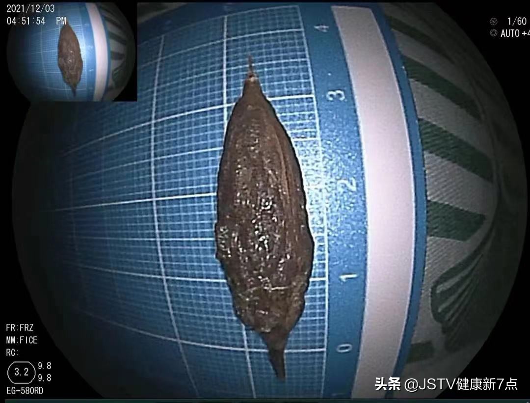 腹痛不止可能是什么原因,腹痛不舒服是什么症状