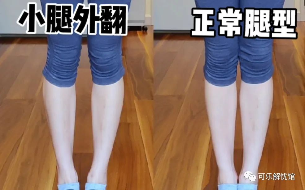 小腿外翻直腿教程,小腿外翻还细怎么练