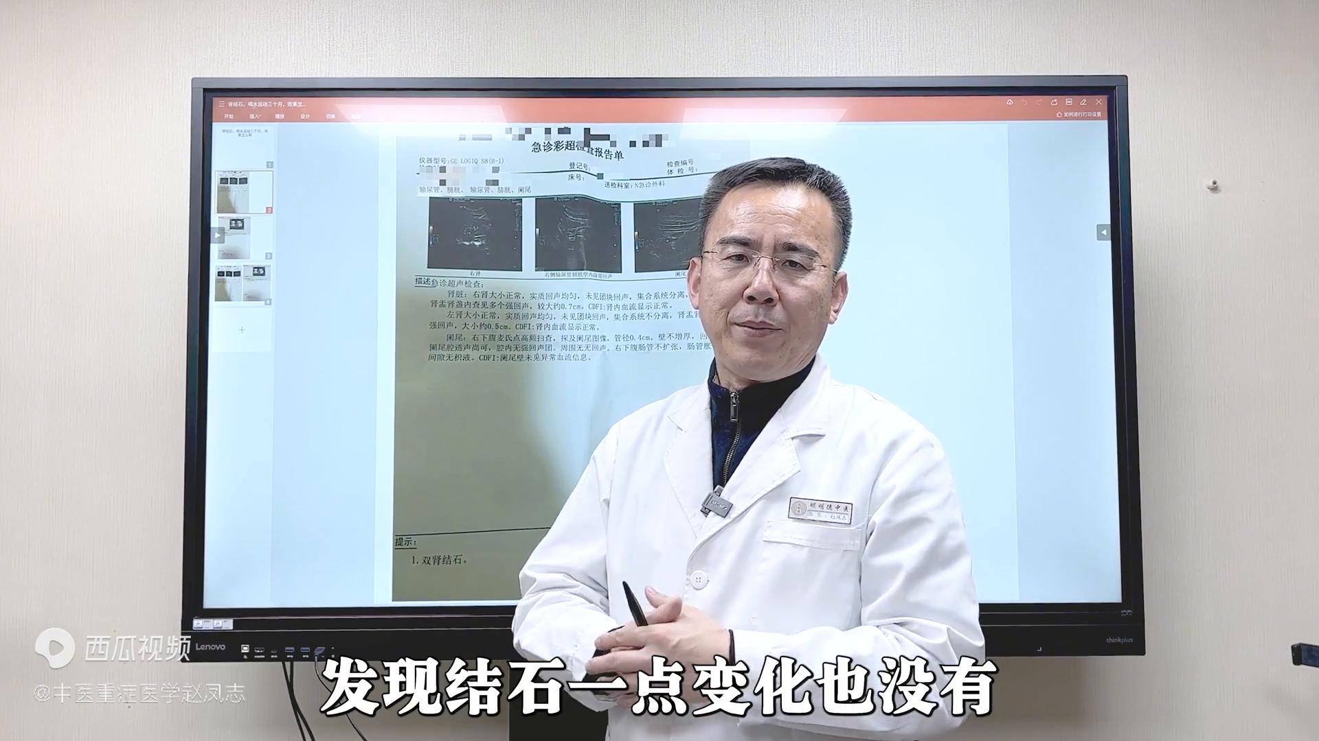 双肾结石，服药调理60天，结石消失不见！