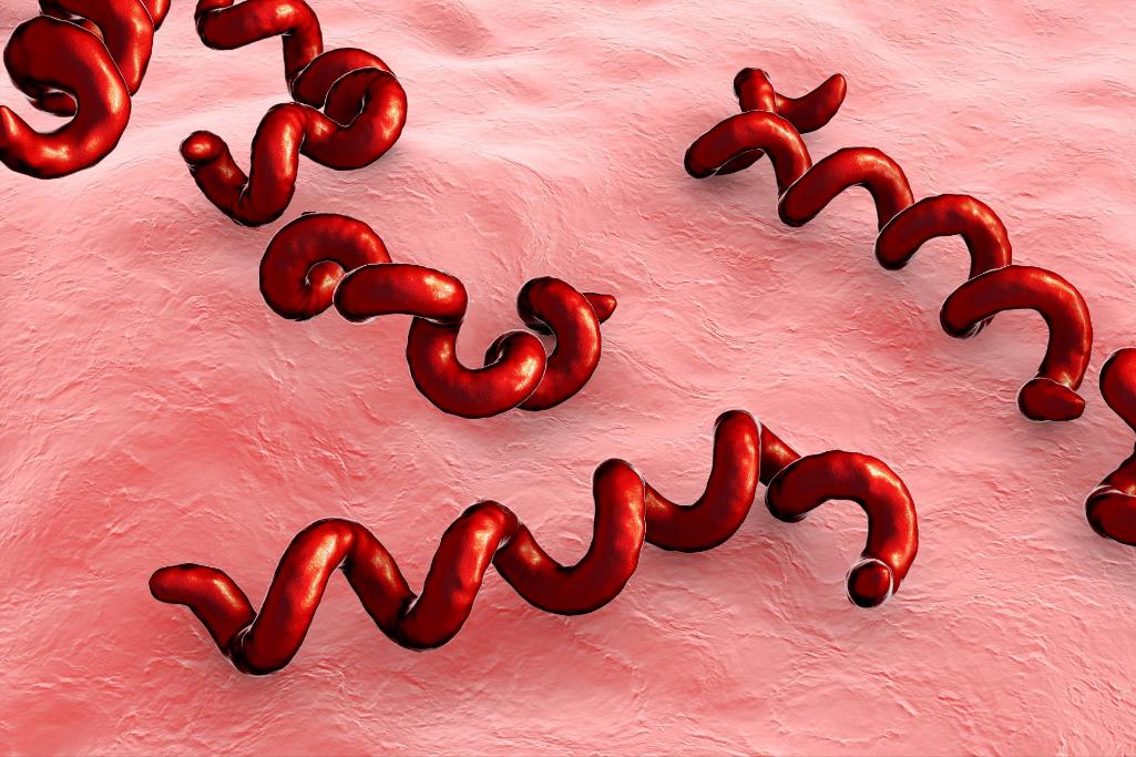 梅毒是怎么出现在人类身上,梅毒是怎么被感染的