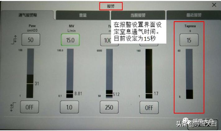 呼吸机：报警设置、心脏按压时的呼吸机设置