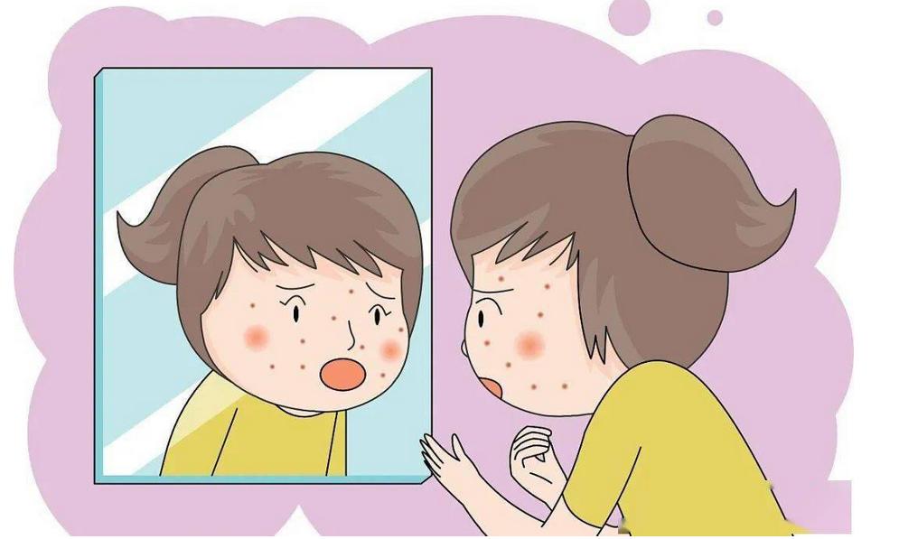 祛痘为什么医生一般不建议光动力,光疗仪器和祛痘产品