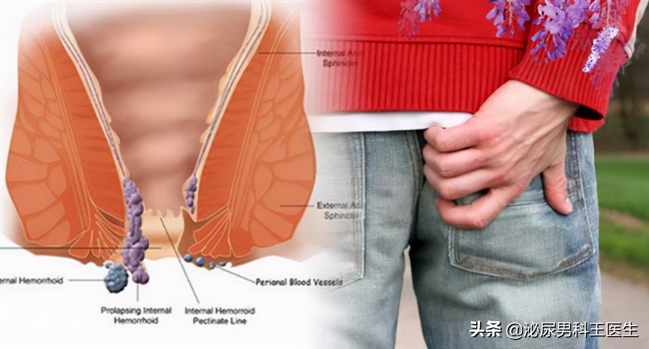 肛门瘙痒潮湿有分泌物怎么治疗,肛门潮湿还痒是什么症状