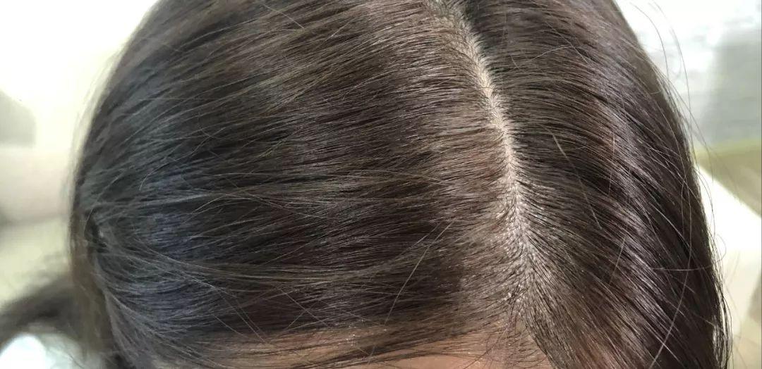 最常用的洗发水就是飘柔和清扬,去屑洗发水推荐海飞丝清扬