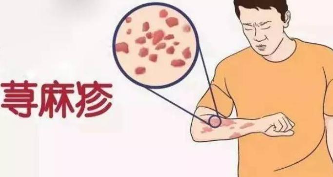 防风通圣丸治感冒效果好啊,中成药防风通圣丸的主治功能