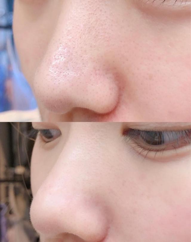 连续三天不洗脸起皮,连续3天不洗脸会怎么样