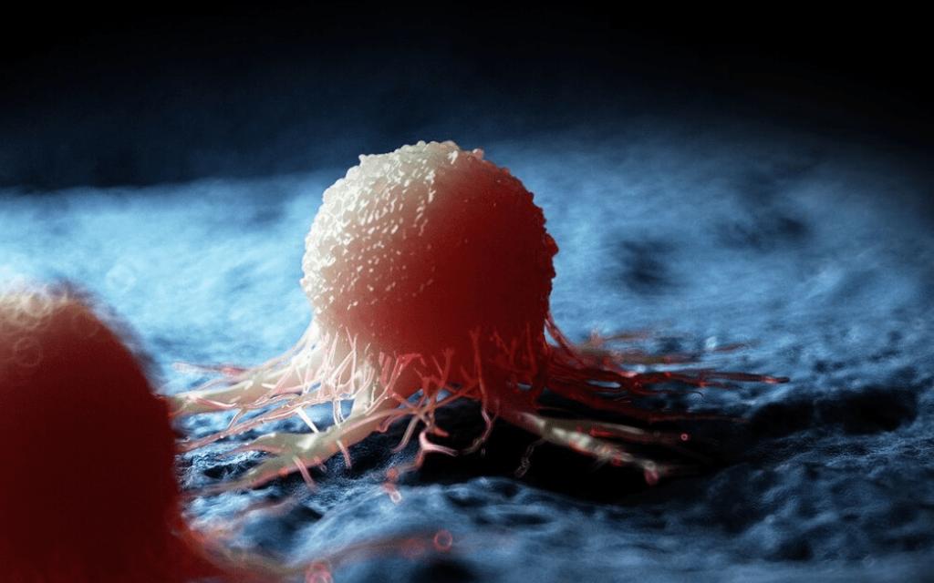 从炎症到癌症大约要几年时间,炎症发展到癌症需要多长时间