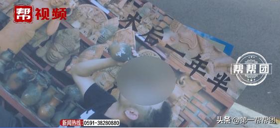 花三万多元植发反被拉低颜值,花一万多块钱植发值不值