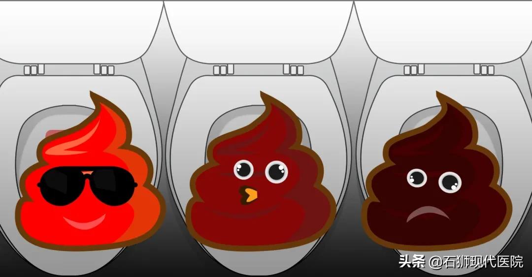 便血挂肛肠外科,便血一般肛肠外科怎么检查