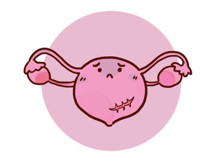 夫妻借了20万做试管婴儿,黑龙江夫妇借22万做试管