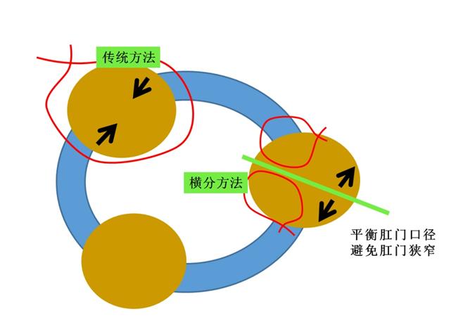 痔疮经久不愈用什么药,久痔如何治疗