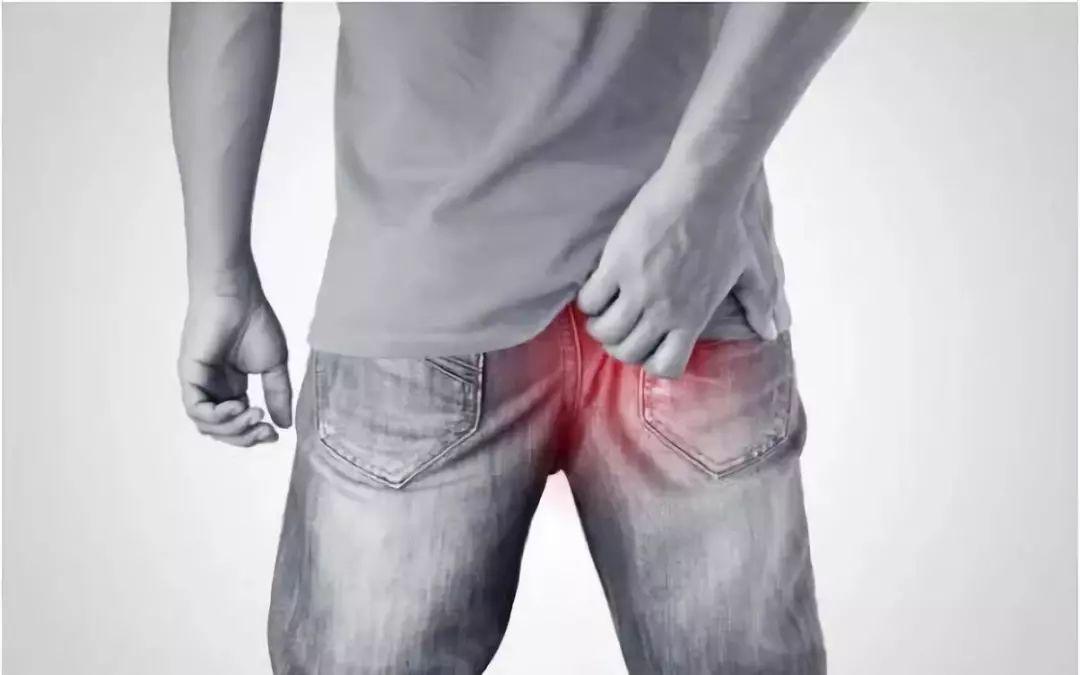 您有“洗屁股”的习惯吗？医生：经常清洗肛门，或能预防4种疾病