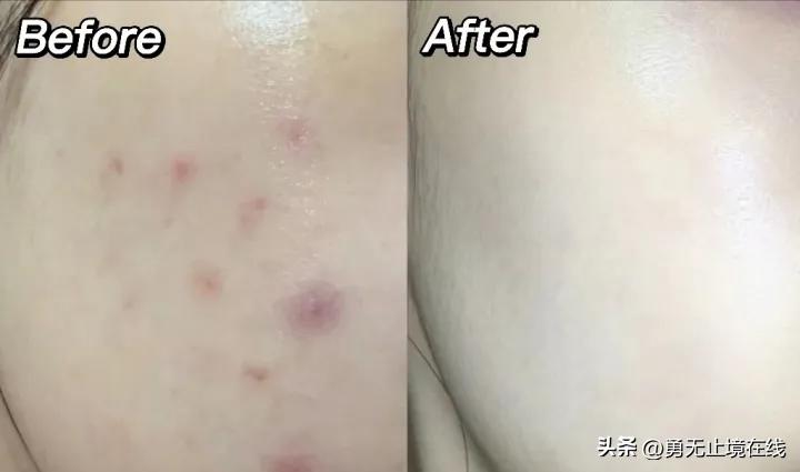 热门水乳真实测评｜避免智商税高性价比保湿美白修复水乳套装推荐