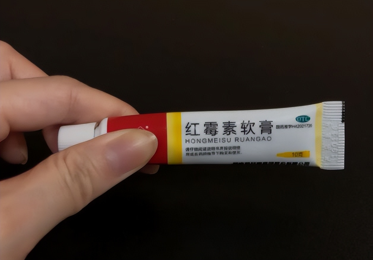 老年斑用红霉素软膏可以除掉吗,快速消除老年斑的小妙招红霉素