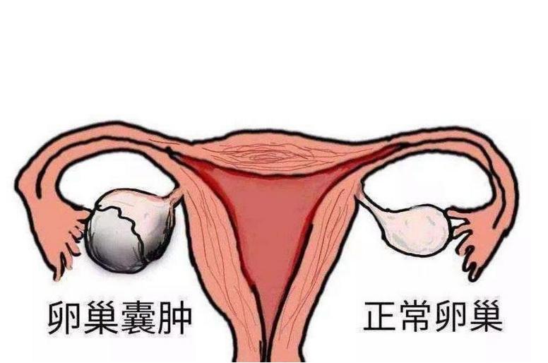 谢娜刚嫁给张杰,就因病切除了单侧输卵管,张杰:我只要她健康!