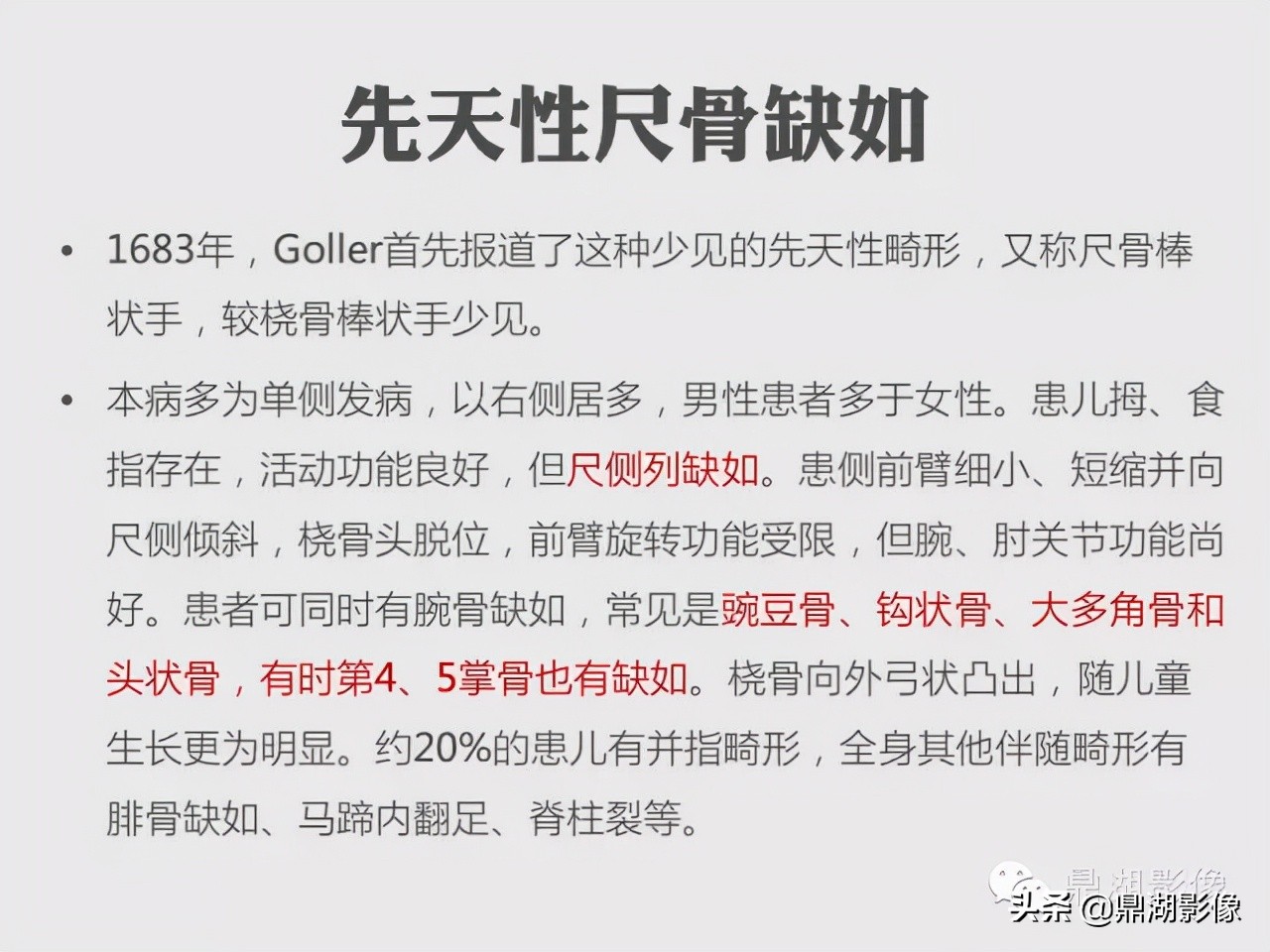 先天桡骨缺失畸形能治疗吗,先天性桡骨发育不良