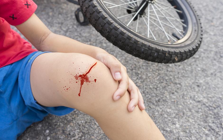 婴儿摔了头怎么判断严重不严重,宝宝摔了脸之后怎么判断有没有事