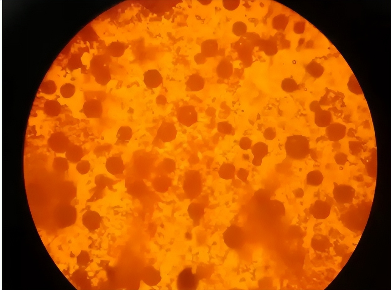 甲硝唑误吃了有什么影响,甲硝唑再好用也要警惕4种副作用