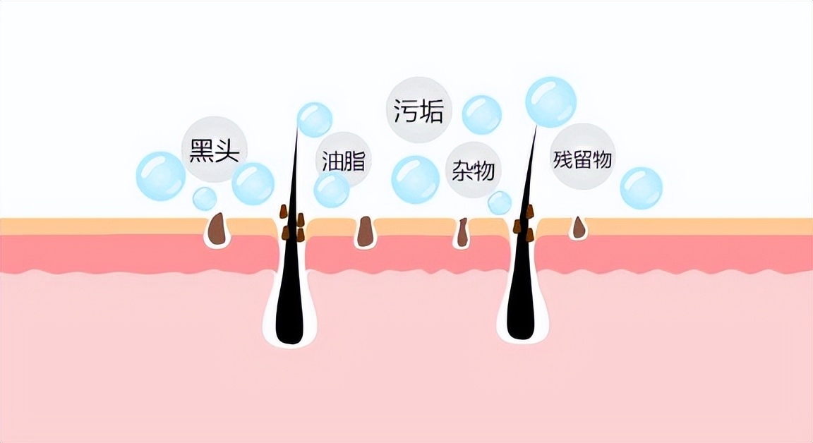 毛孔粗大的正确护肤步骤是什么,毛孔粗大护肤的正确步骤图