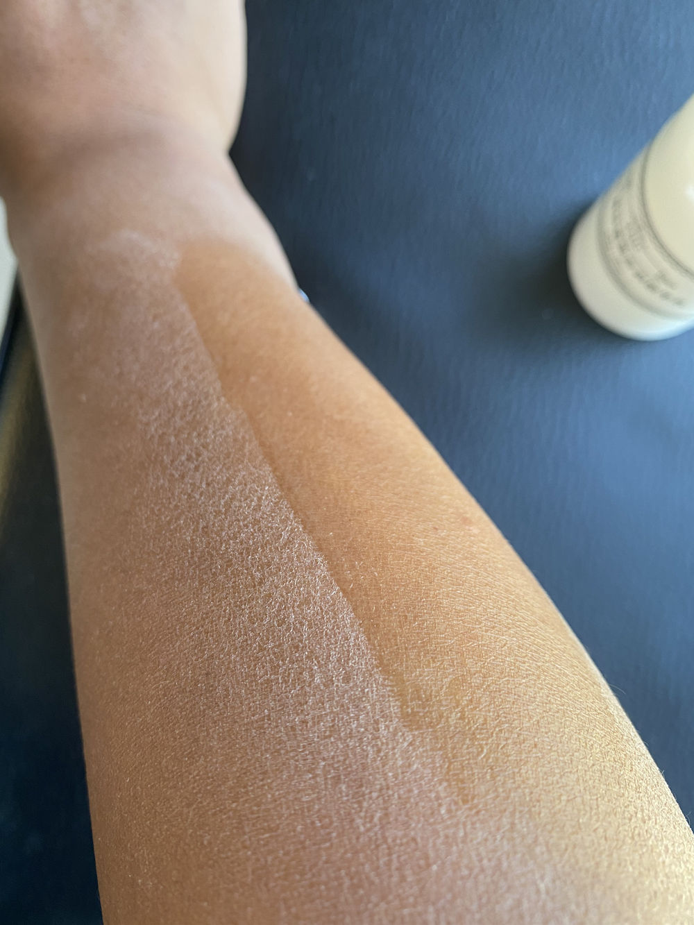 身上老是洗不干净是怎么回事,洗完澡皮肤干痒起白皮屑怎么回事