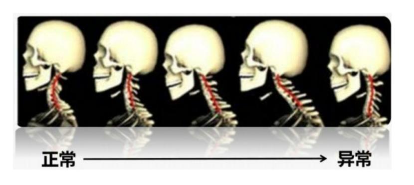 您的脊柱还好吗,健康的脊柱有多重要看完你就知道