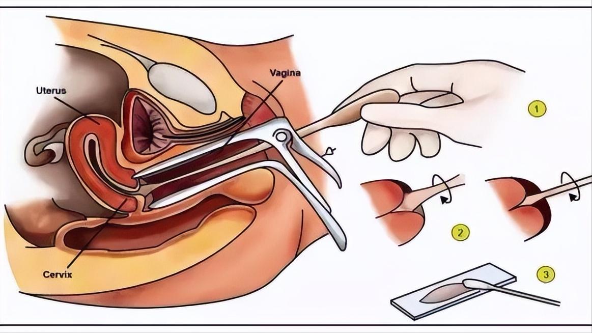 妇科检查的最佳时间表,妇科检查最佳时间表