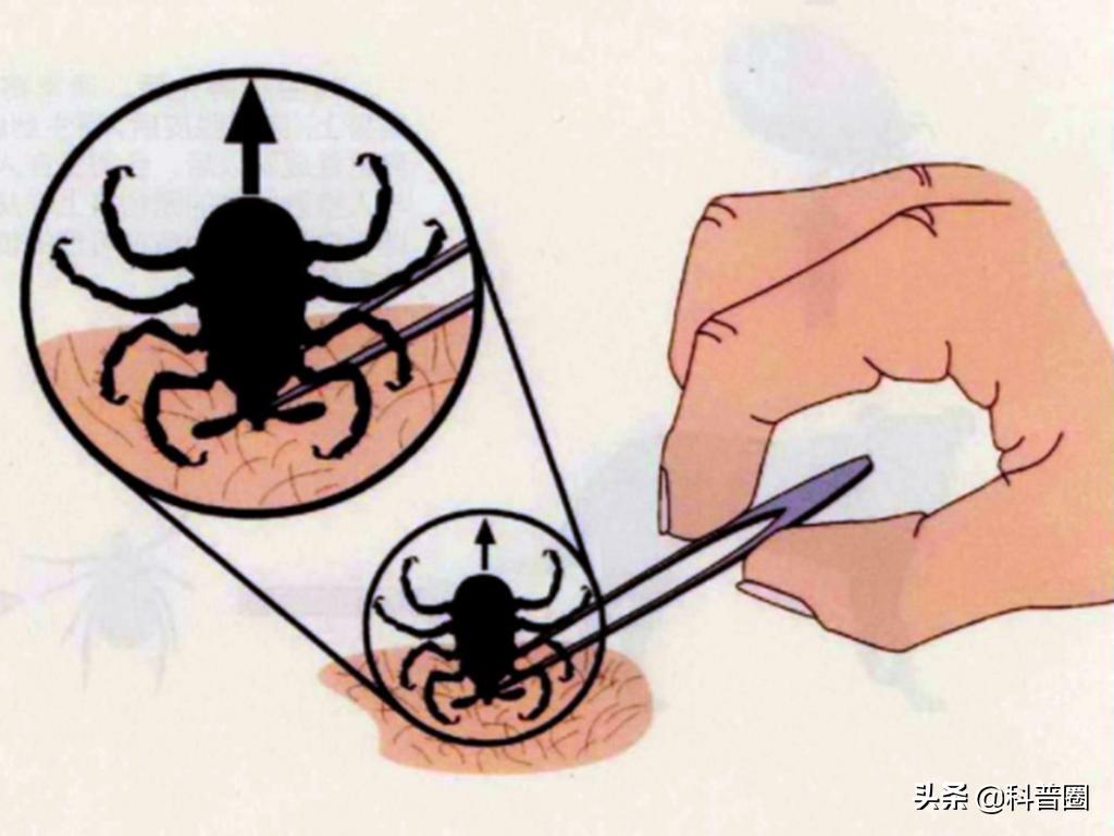 致命蜱虫,比蜱虫还可怕