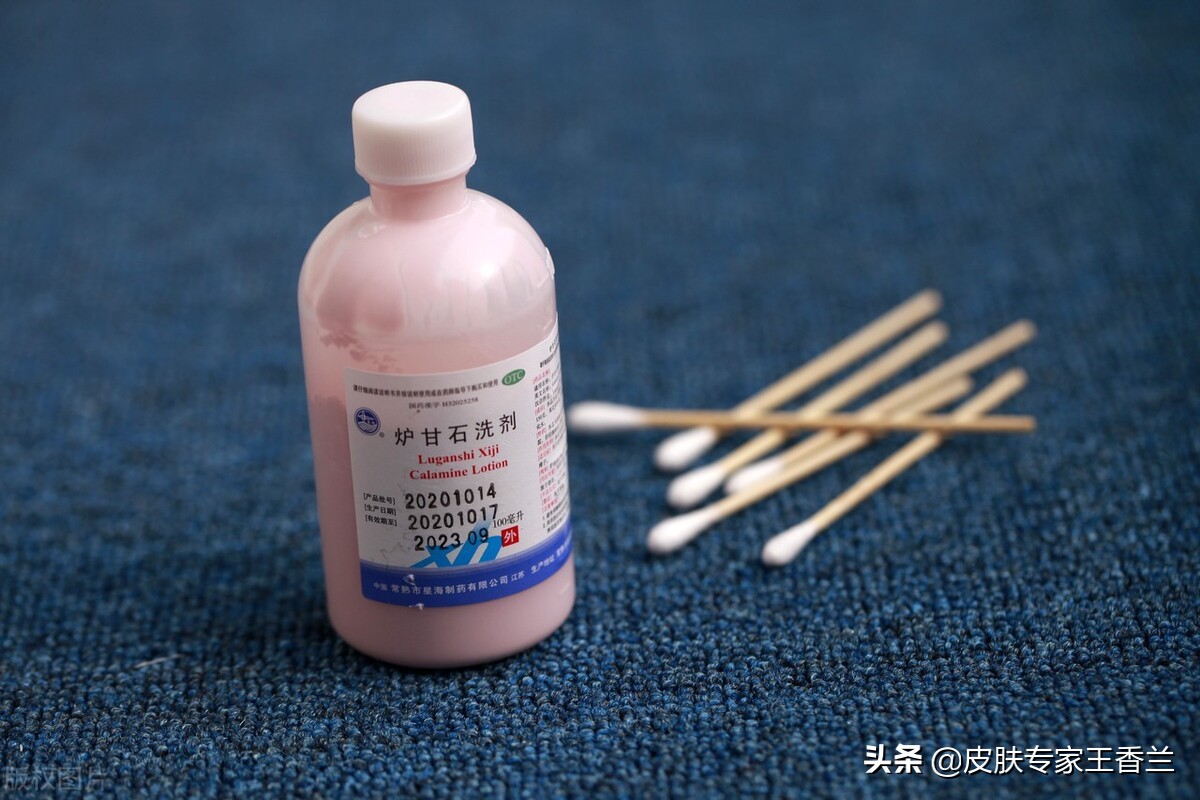 炉甘石洗剂可以用于破损皮肤吗,用完炉甘石洗剂皮肤干燥怎么缓解