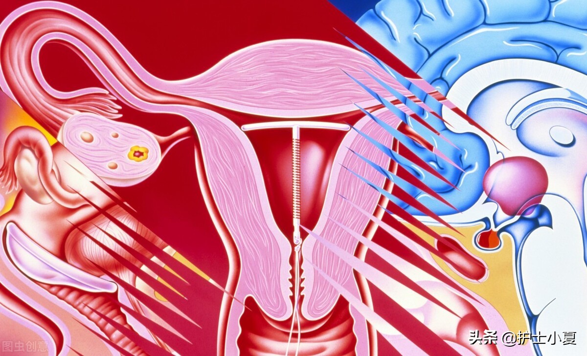 40以上的女性采用哪种避孕方法好,40以上女人还用避孕吗