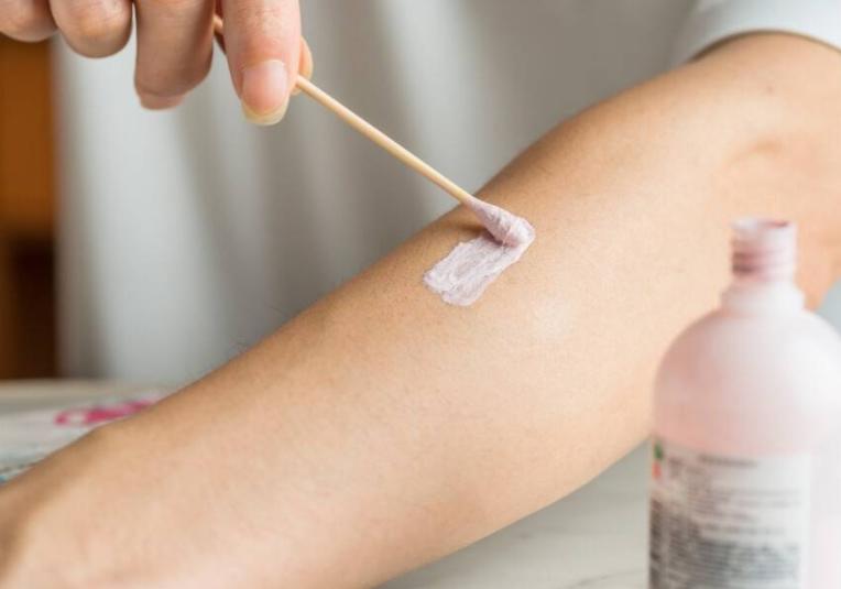 世卫组织推荐炉甘石,炉甘石洗剂哪个牌子的效果比较好