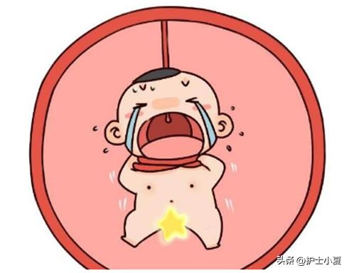 脐带绕颈血流信号什么意思,脐带绕颈影响宝宝有什么异常表现