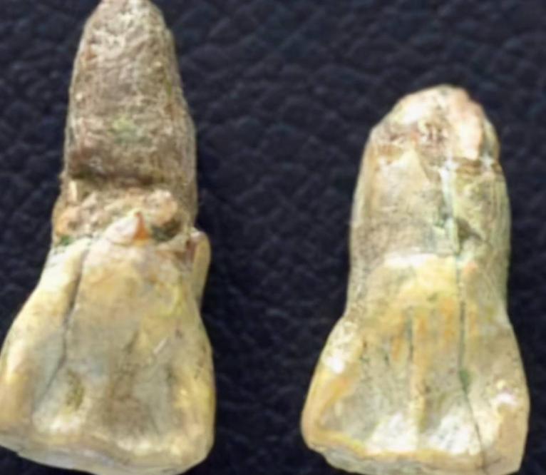 华夏子孙的3个印记:门牙、褶子和脚趾,与生俱来且无法抹去