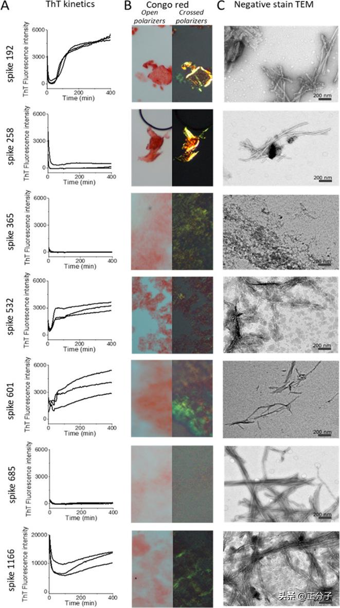 新冠引起间质性改变,新冠后遗症引起淀粉样变性