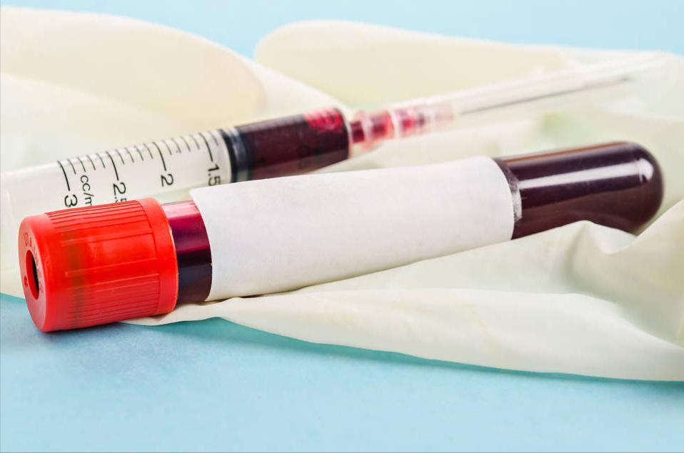 发现尿蛋白要住院吗,发现尿蛋白是肾炎是不是很严重了