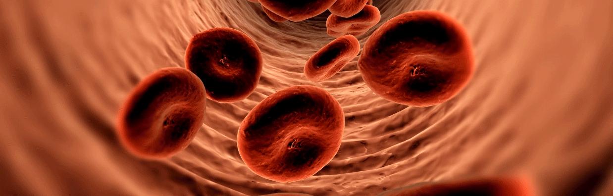 治疗强直性脊柱炎必须按体质治吗,针对强直性脊柱炎最好的锻炼方法