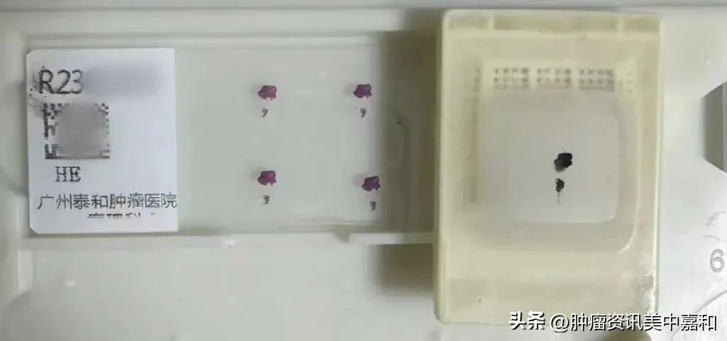 he切片和白片的区别,病理切片和白片的区别